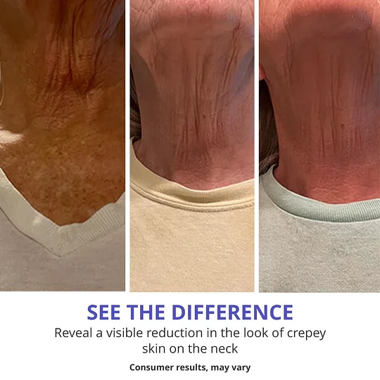 Neck Cream - Tighten & Lift Firming Neck Cream for Crepey Skin Shipping From USA