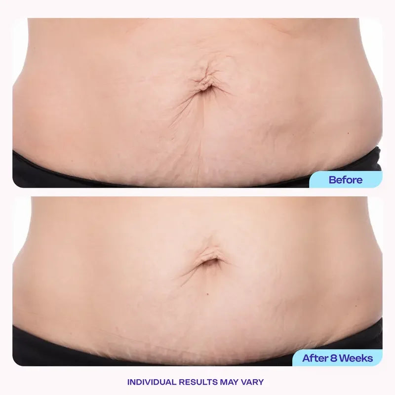 New!Tighten & Smooth Belly Firming Cream