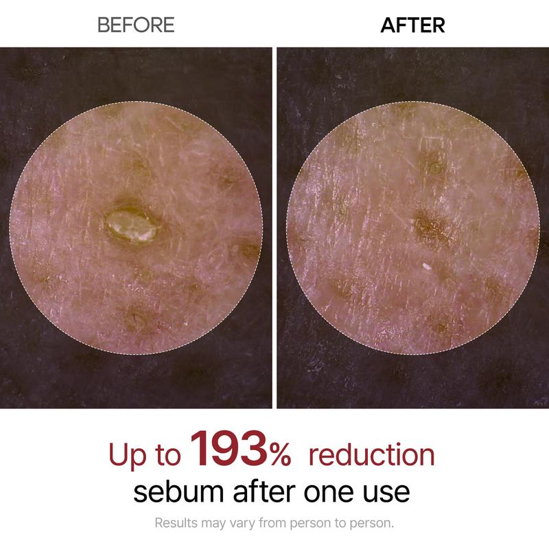 Serums for Brightening, Exfoliating, and Moisturizing
