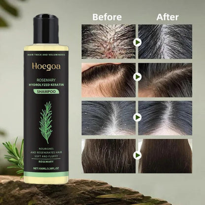 Rosemary Shampoo BoostHair Growth, Control Oil & Dandruff,Soothe Scalp lritation & RestoreShine-hz