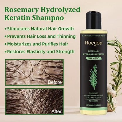 Rosemary Shampoo BoostHair Growth, Control Oil & Dandruff,Soothe Scalp lritation & RestoreShine-hz