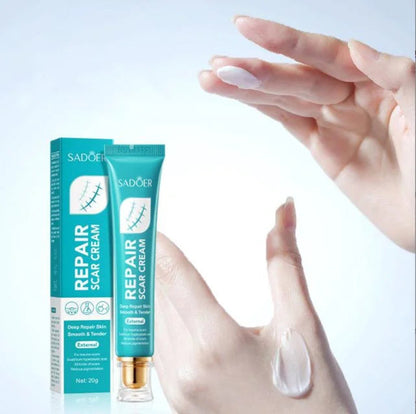 Scar Cream for Men andWomen, Skin Smoothing Firming and Fading, Skinremoval Cream-hz