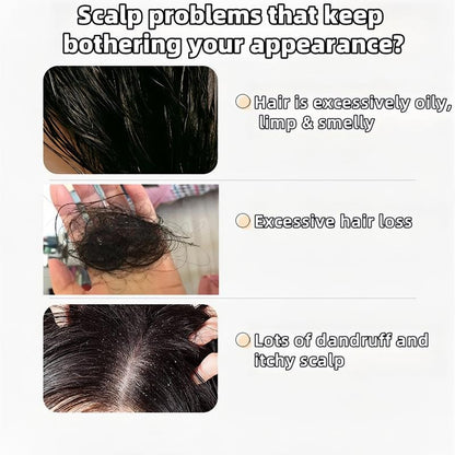 REMIMPI Anti-Hair Fall Hair Loss Treatment Shampoo Oil Control Anti dandruff Haircare Ginseng Ginger Help Hair Growth Jojoba Oat Repair Reduce Hair Loss Scalp Cleanser Conditioner 300ML-hz