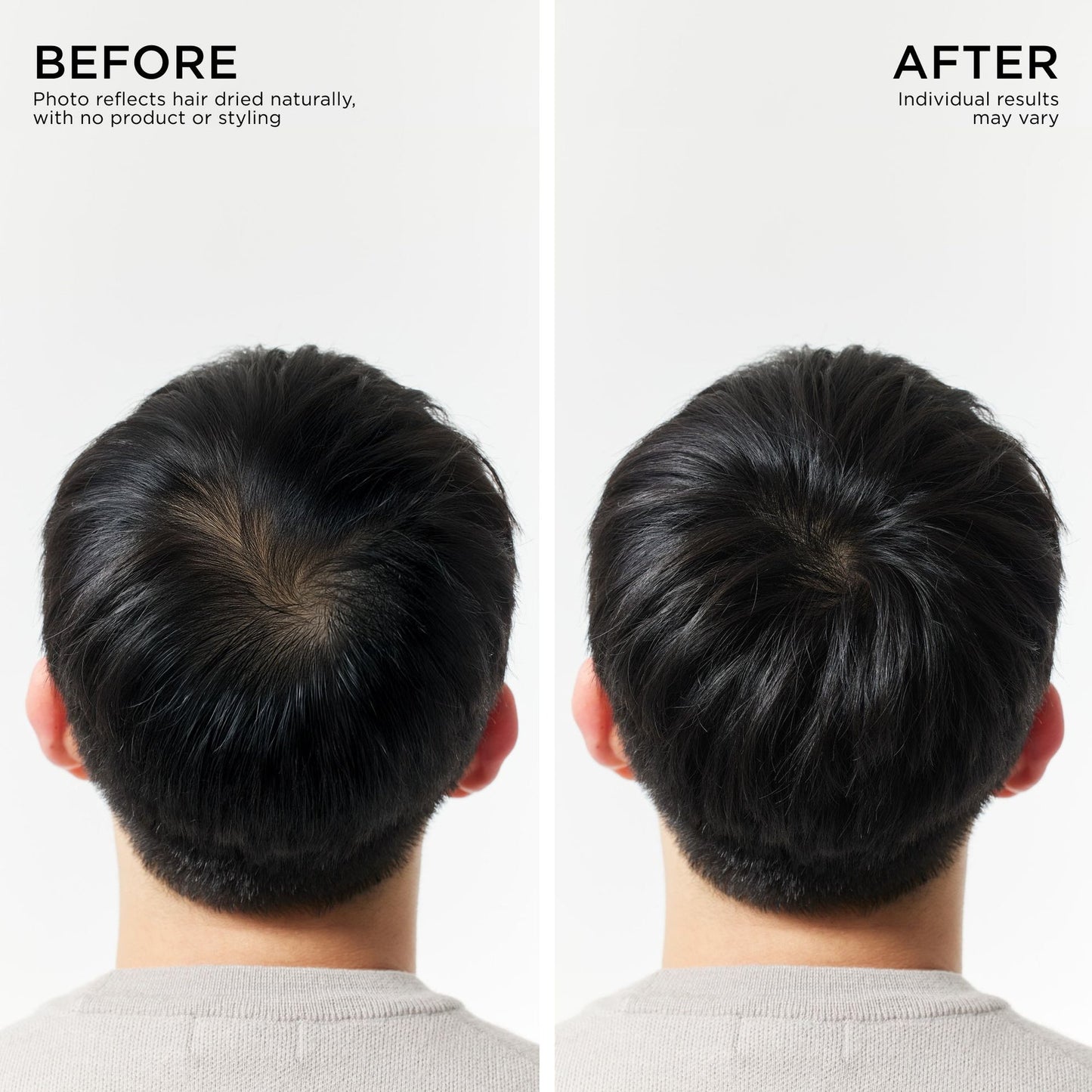 Ending Soon-70% OFFToday Only: Rapid RegrowthHair Serum Roll-On-LGH