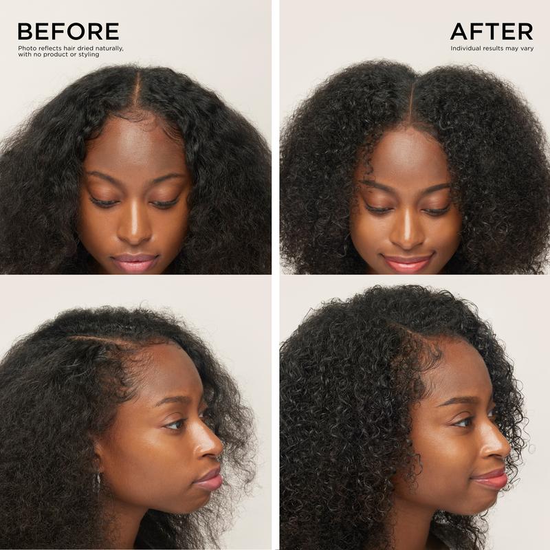 Ending Soon-70% OFFToday Only: Rapid RegrowthHair Serum Roll-On-LGH