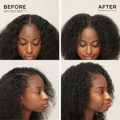 Ending Soon-70% OFFToday Only: Rapid RegrowthHair Serum Roll-On-LGH