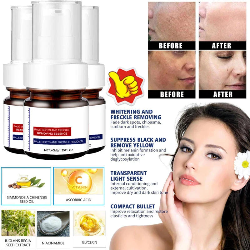 Instant Glow Therapy: Fade freckles, erase spots & reveal luminous, youthful skin with Vitamin C Essence!-LGH