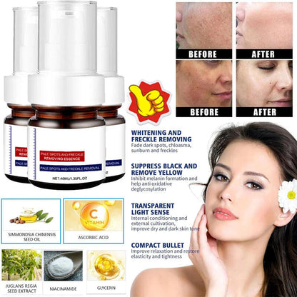 Instant Glow Therapy: Fade freckles, erase spots & reveal luminous, youthful skin with Vitamin C Essence!-LGH