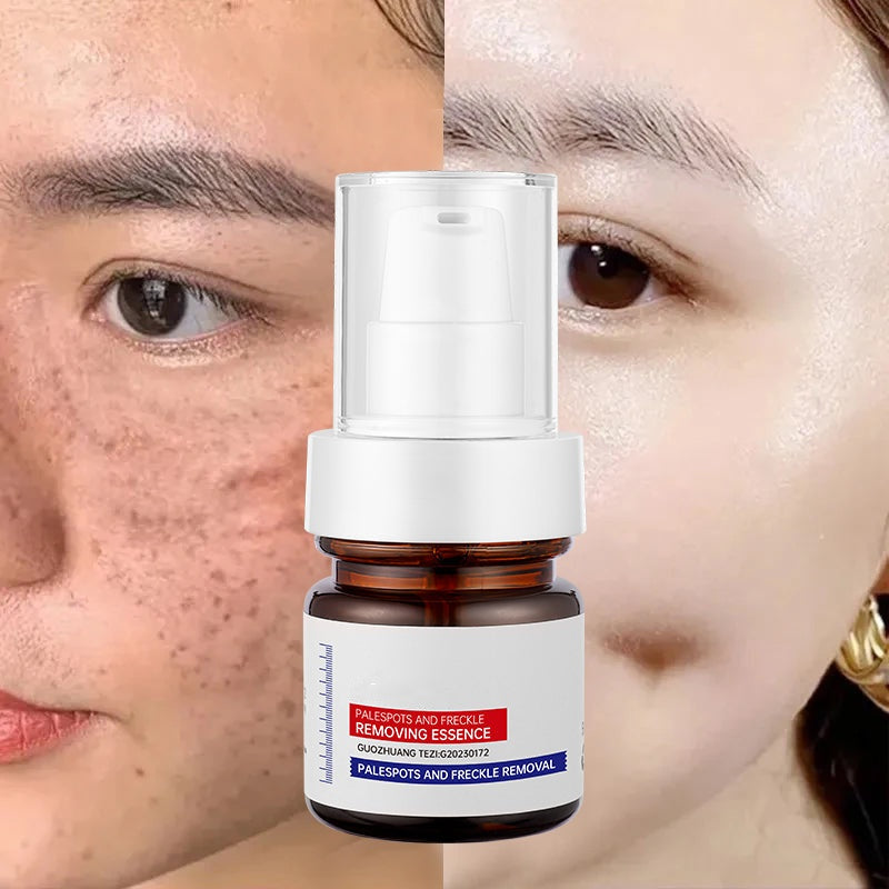Instant Glow Therapy: Fade freckles, erase spots & reveal luminous, youthful skin with Vitamin C Essence!-LGH