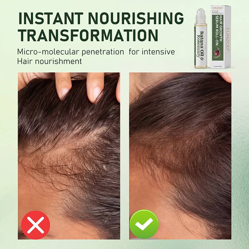FUNZOO®  Rosemary Hair Growth Serum 20ml (3% Rosemary + 3% Redensyl) | Scalp Support + Stronger Hair | For Men & Women