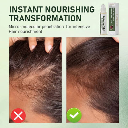 FUNZOO®  Rosemary Hair Growth Serum 20ml (3% Rosemary + 3% Redensyl) | Scalp Support + Stronger Hair | For Men & Women