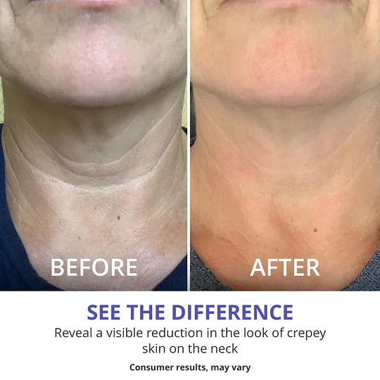 Neck Cream - Tighten & Lift Firming Neck Cream for Crepey Skin Shipping From USA