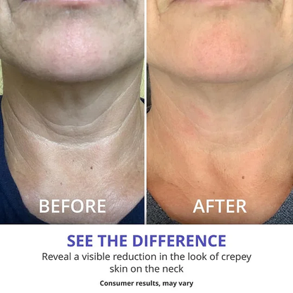 Neck Cream - Tighten & Lift Firming Neck Cream for Crepey Skin Shipping From USA