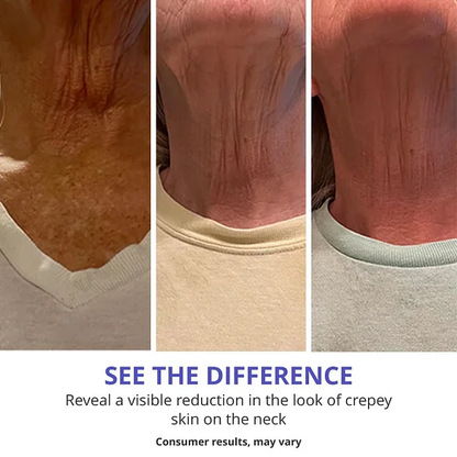 Neck Cream - Tighten & Lift Firming Neck Cream for Crepey Skin Shipping From USA
