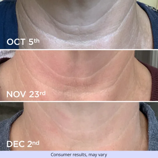 Neck Cream - Tighten & Lift Firming Neck Cream for Crepey Skin Shipping From USA