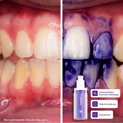 Hismile v34 Colour Corrector - Tooth Stain Concealer, Teeth Brightening Booster, Purple Toothpaste, Colour Correcting, Hismile V34