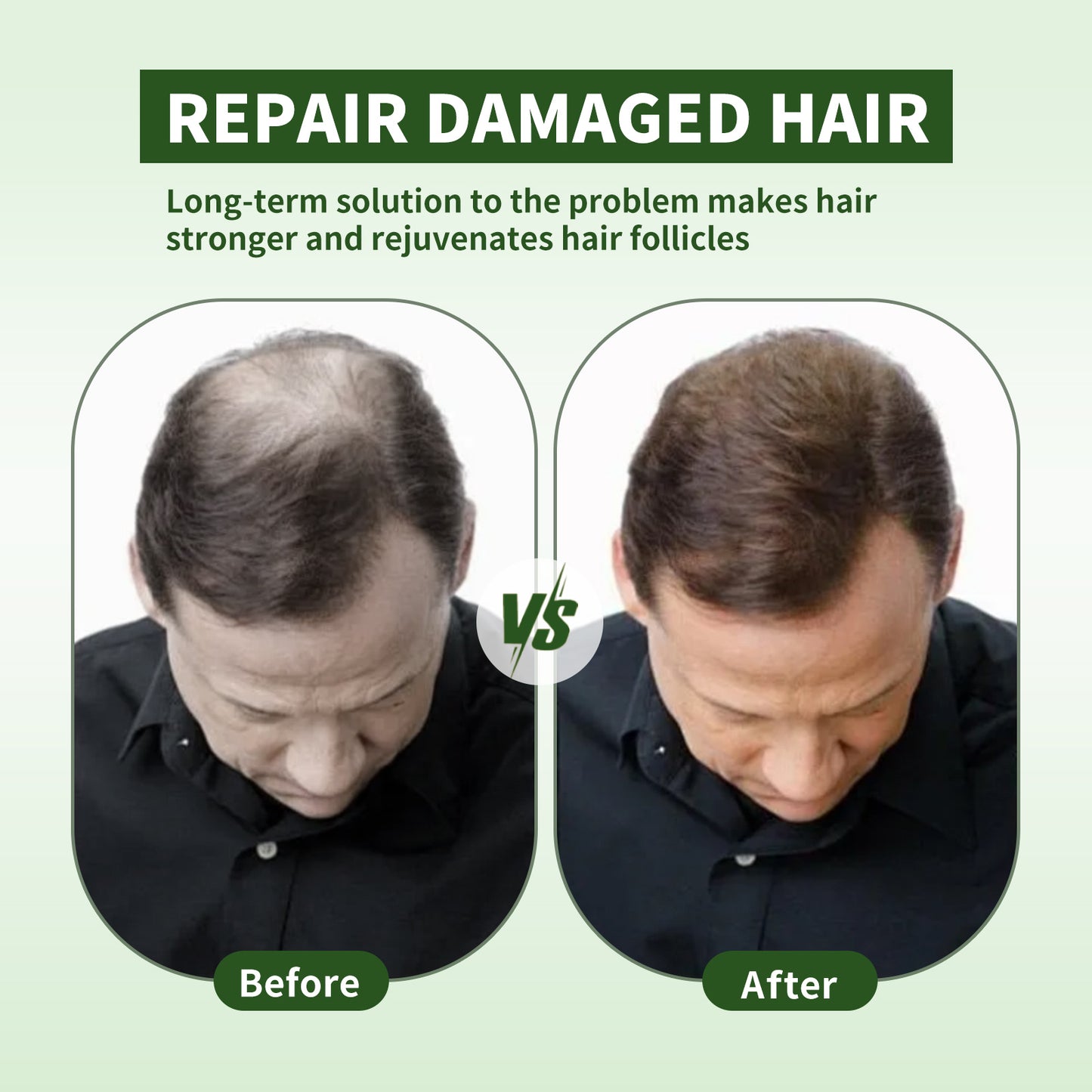 FUNZOO Hair Growth Serum Roll-On | Batana Oil & Rosemary Scalp Care | Nourishing & Hair Regrowth 20ml