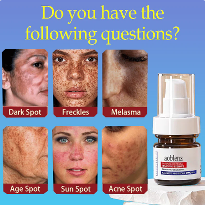 Dark Spot Remover for Face and Body - Dark Spot Corrector Serum for Acne Scars, Melasma, Age, Sun, Black Spots