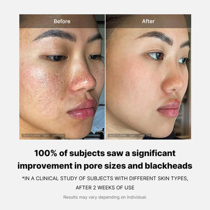 Mix & Match Toner Padㅣ Pore, Use After Spot, Brightening Care for Clear & Glass Glow SkinㅣTikTok Viral Toner Pads