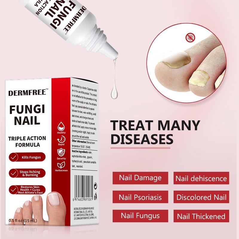 Toenail Fungus Treatment Extra Strength, Antifungal Solution for Toenail or Fingernail, Triple Action Formula for Remove Fungal, Repair and Renewal Damaged Nails, 0.5 Fl Oz-XDX