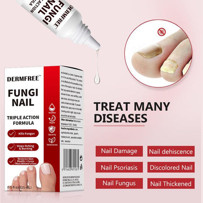 Toenail Fungus Treatment Extra Strength, Antifungal Solution for Toenail or Fingernail, Triple Action Formula for Remove Fungal, Repair and Renewal Damaged Nails, 0.5 Fl Oz-XDX