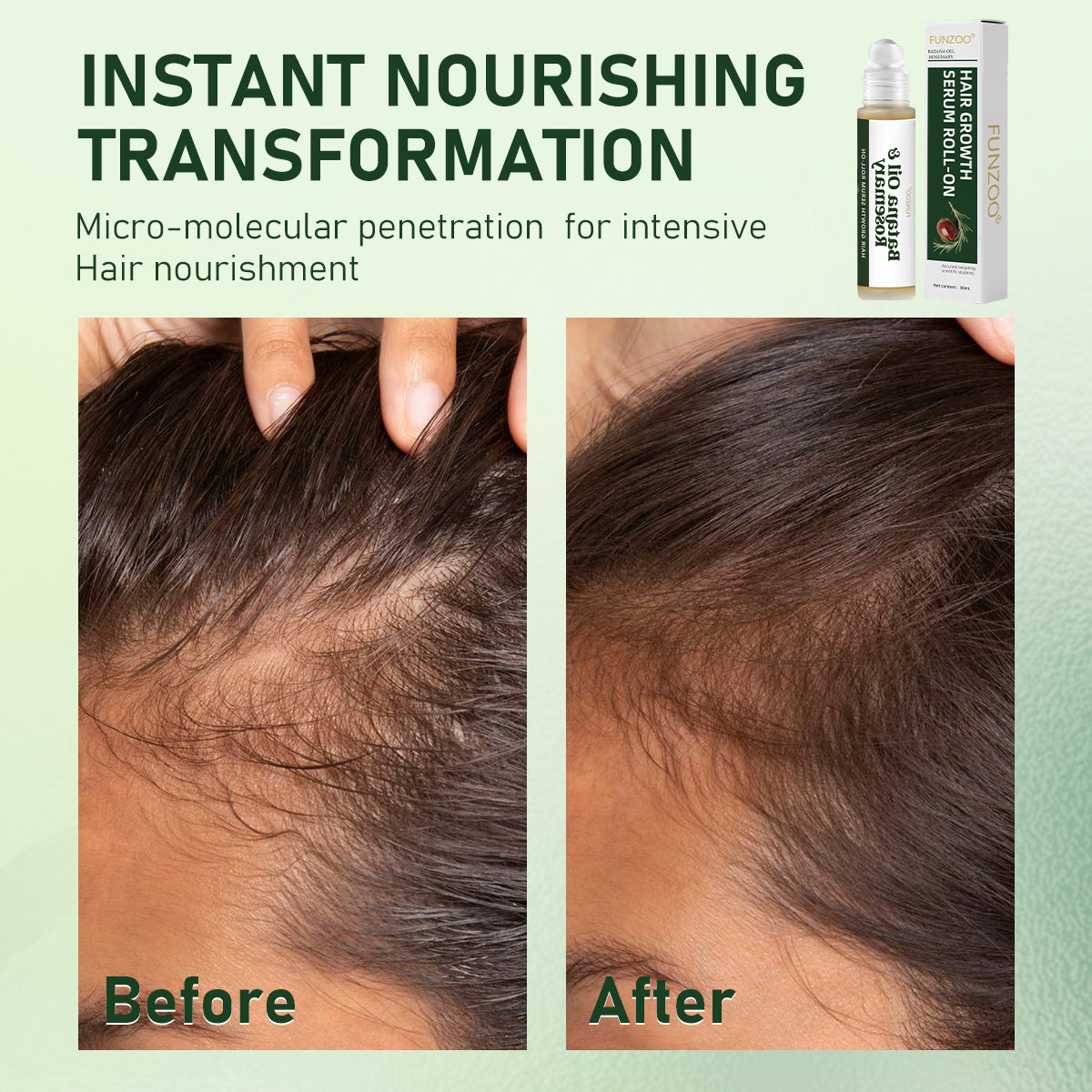 FUNZOO Hair Growth Serum Roll-On with Batana Oil & Rosemary for Scalp Care - Nourishing & Hair Regrowth Formula - 20ml