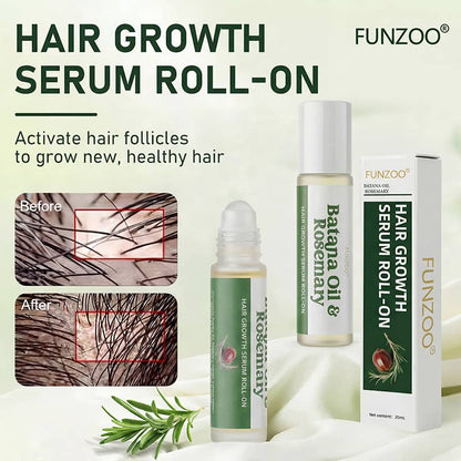 FUNZOO®  Rosemary Hair Growth Serum 20ml (3% Rosemary + 3% Redensyl) | Scalp Support + Stronger Hair | For Men & Women
