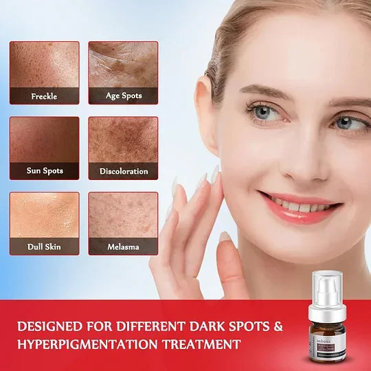Dark Spot Remover for Face and Body - Dark Spot Corrector Serum for Acne Scars, Melasma, Age, Sun, Black Spots