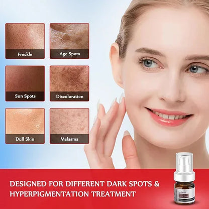 Dark Spot Remover for Face and Body - Dark Spot Corrector Serum for Acne Scars, Melasma, Age, Sun, Black Spots