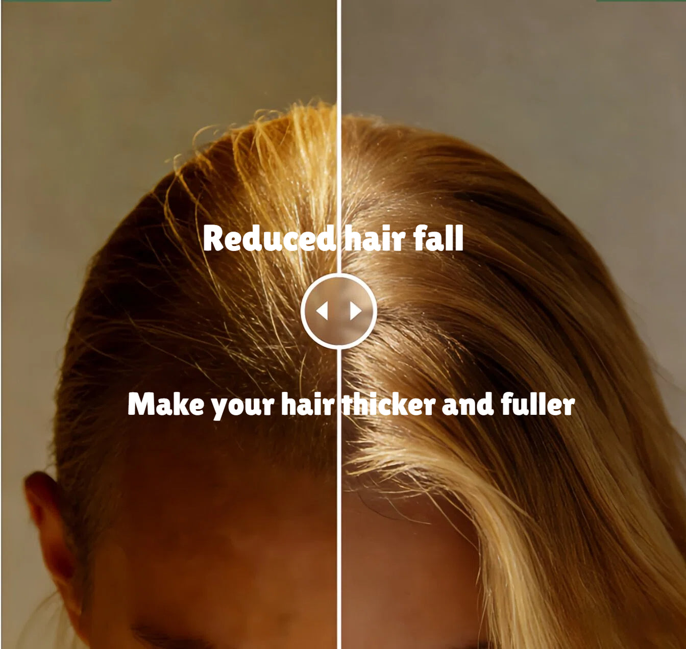 FUNZOO®  Rosemary Hair Growth Roll-On Serum 20ml | Restore Your Thick & Lush Hair | For Men & Women - Twice Daily Application, Results in 3 Weeks