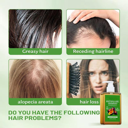 Batana Oil Shampoo -Promote Hair Growth,Strengthening,& Cleansing 10.14 0z (300ml) withNatural Extract for Healthy Hair